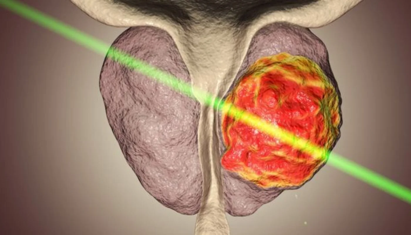 Cystoscopy, Endourology, and Laser Treatment Services in Hyderabad